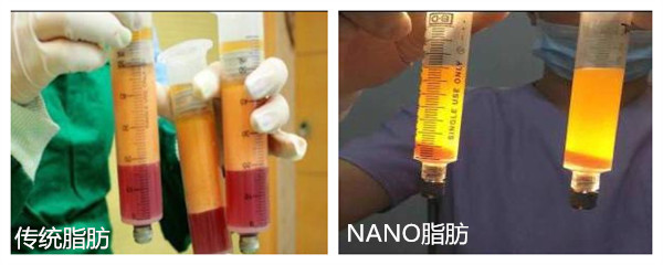 脂肪對比.jpg