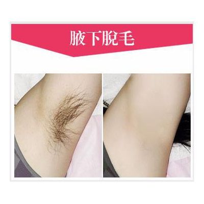 脫腋毛手術.jpg